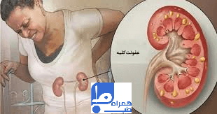 عفونت کلیه 